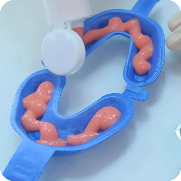 Fluoride Application